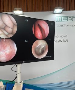 MÁY NỘI SOI TAI MŨI HỌNG